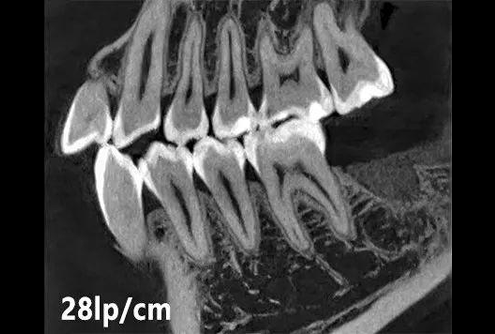 High resolution dental CBCT image